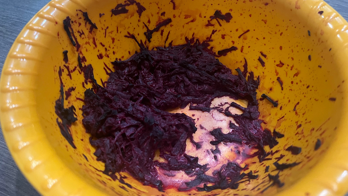 Не забывайте заботиться о печени: привычки, которые приводят к гепатозу