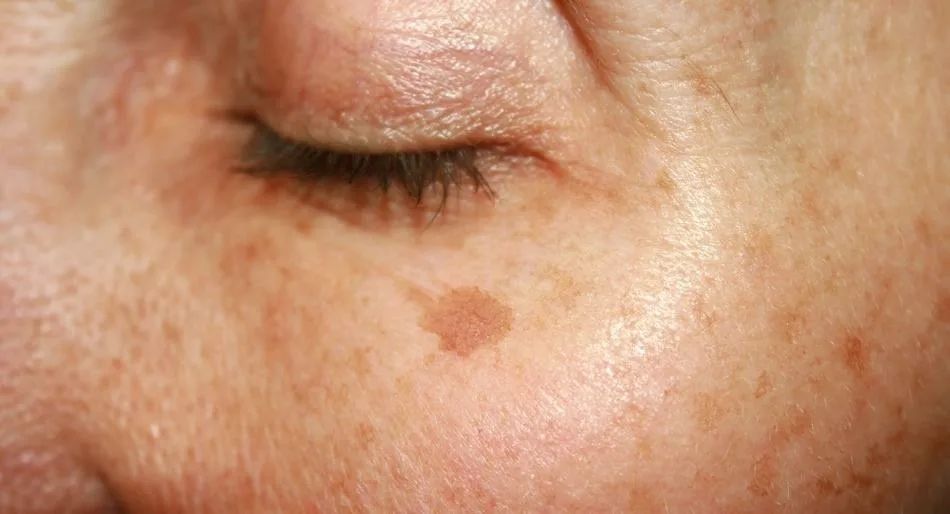 ������ �������� ����� ����: ��� �������� �������� ���������� �� ���������� �����